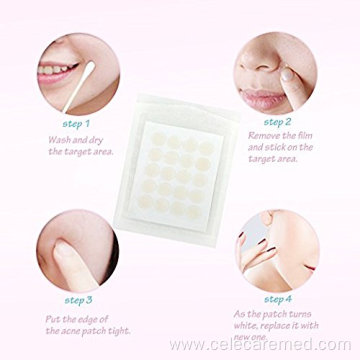 Natural Acne Spot Stickers Hydrocolloid Absorbing Acne Patch